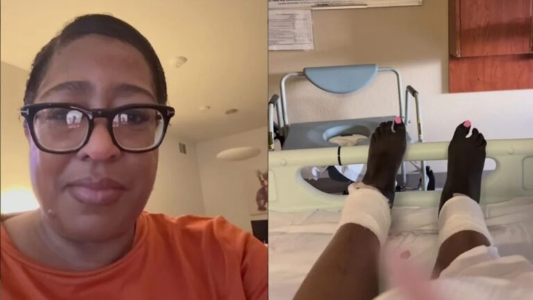 Após gripe, mulher tem choque séptico e precisa amputar as pernas